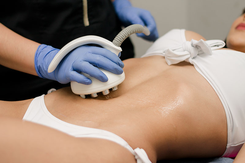 RADIOFRECUENCIA VENUS